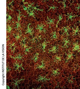 Subretinal macrophages on horizontal mounts of Retinal Pigmented Epithelium (EPR). In red, the cells of the EPR (honeycomb). In green, the macrophages.