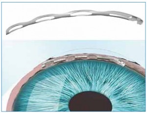 Fig. 8. Il CyPass.