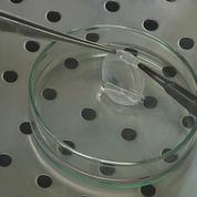Ph. 1. Un lembo di epitelio corneale coltivato in vitro (per concessione del Centro di Medicina Rigenerativa “Stefano Ferrari”).