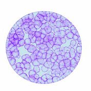 Ph. 3. Colonie di cellule epiteliali ottenute da una cellula staminale (per concessione del Centro di Medicina Rigenerativa “Stefano Ferrari”).