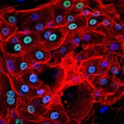 Ph. 5. Cellule corneali viste al microscopio a fluorescenza (per concessione del Centro di Medicina Rigenerativa “Stefano Ferrari”).