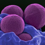 Antibiotic resistance: the emergency of the new millennium