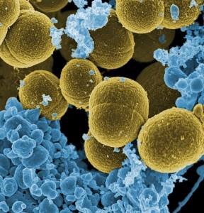 Bacteria of the Staphilococcus aureus strain that escape destruction by white blood cells.
