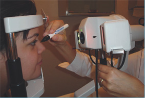 Fig. 2. Marcatura pre-operatoria all'oftalmoscopio.