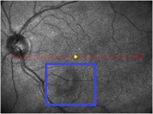 Fig. 8. Nella zona evidenziata è possibile apprezzare l'Anello di Weiss.