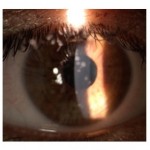 Il microbioma della superficie oculare