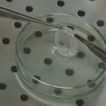 complete eye transplant