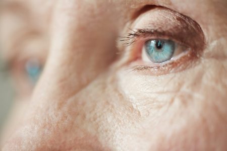 Glaucoma e infiammazione