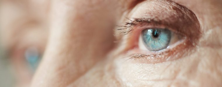 Glaucoma e infiammazione