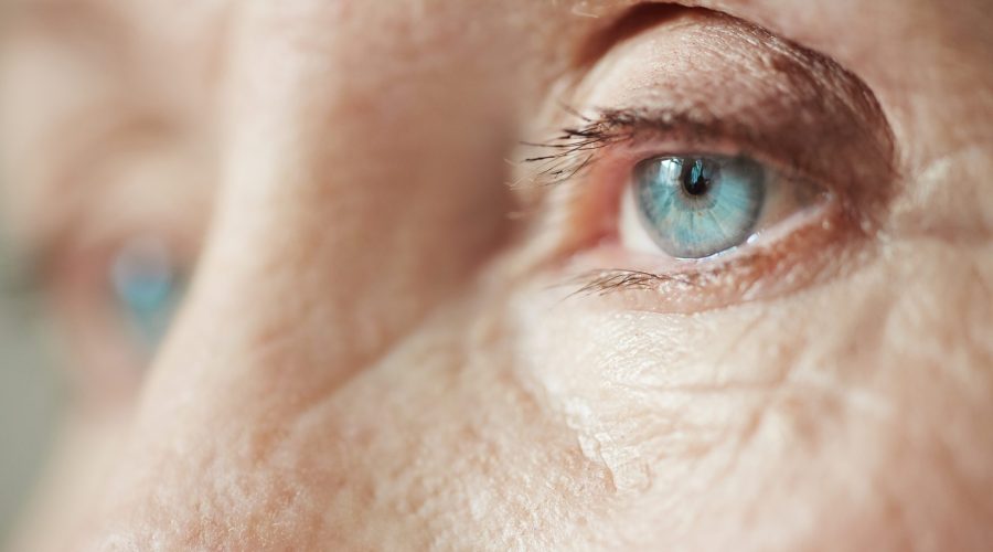 Glaucoma e infiammazione