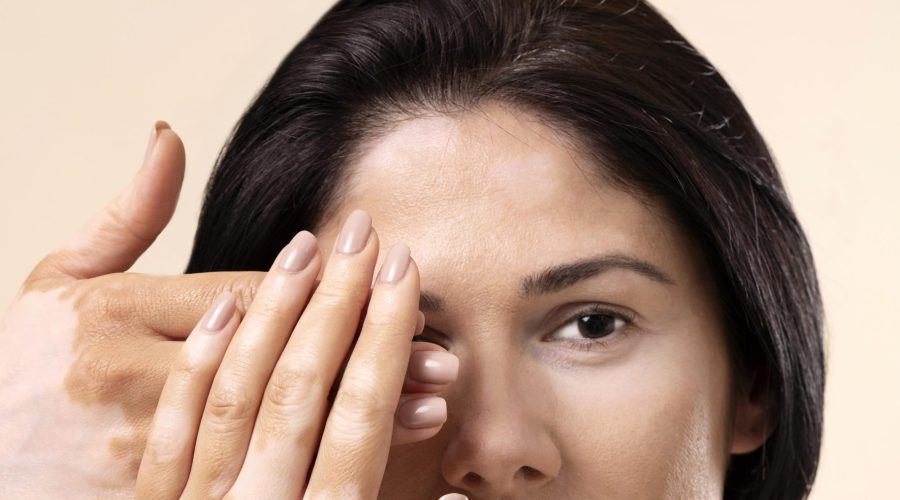 Malattie sistemiche e rischio di glaucoma