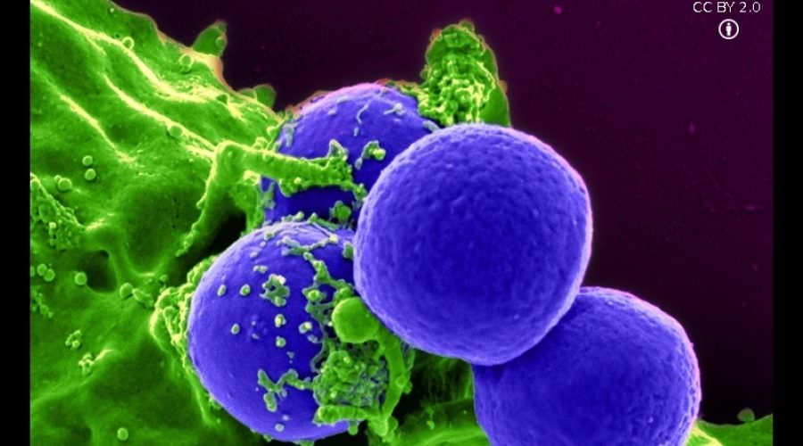 Antibiotici e citotossicità