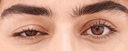 Miastenia gravis: oculisti in prima linea