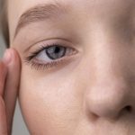 La dermatite palpebrale: come prevenirla