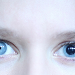 Anisocoria: Cos’è e perché si verifica?
