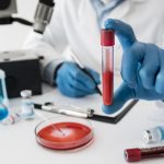 Pemfigoide oculare: i progressi della ricerca