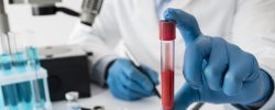 Pemfigoide oculare: i progressi della ricerca