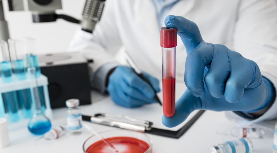 Pemfigoide oculare: i progressi della ricerca
