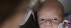 Glaucoma congénito