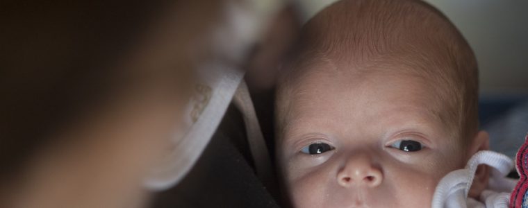 Glaucoma congénito