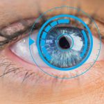 Guida al Trapianto di Cornea