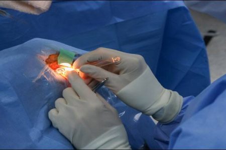 Neuropatia Ottica Ereditaria di Leber e Terapia Genica