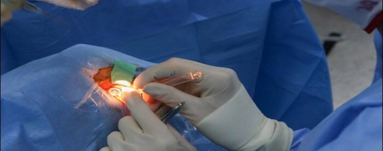 Neuropatía óptica hereditaria de Leber y terapia génica